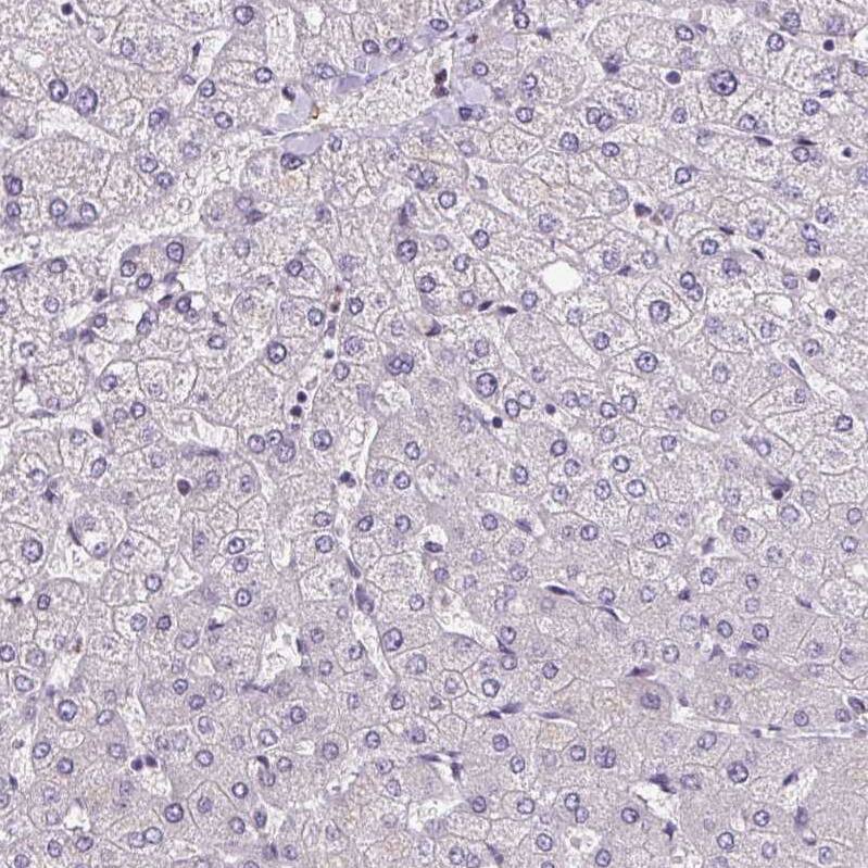 ZFP3 Antibody - BSA Free Immunohistochemistry: ZFP3 Antibody - BSA Free [NBP2-13545]