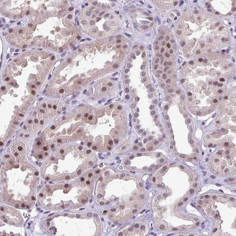 ZFP3 Antibody - BSA Free Immunohistochemistry: ZFP3 Antibody - BSA Free [NBP2-13545]