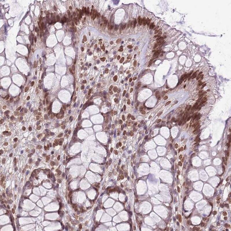 ZGLP1 Antibody - BSA Free Immunohistochemistry: ZGLP1 Antibody - BSA Free [NBP2-13548]