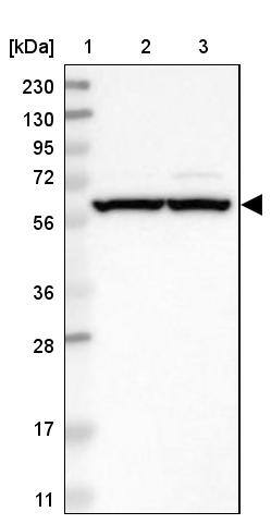 ZMYM5 Antibody - BSA Free Western Blot: ZMYM5 Antibody - BSA Free [NBP2-13551]