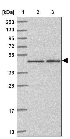 ZNF167 Antibody - BSA Free Western Blot: ZNF167 Antibody - BSA Free [NBP2-13555]