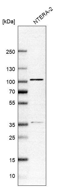 ZNF281 Antibody - BSA Free Western Blot: ZNF281 Antibody - BSA Free [NBP2-13564]