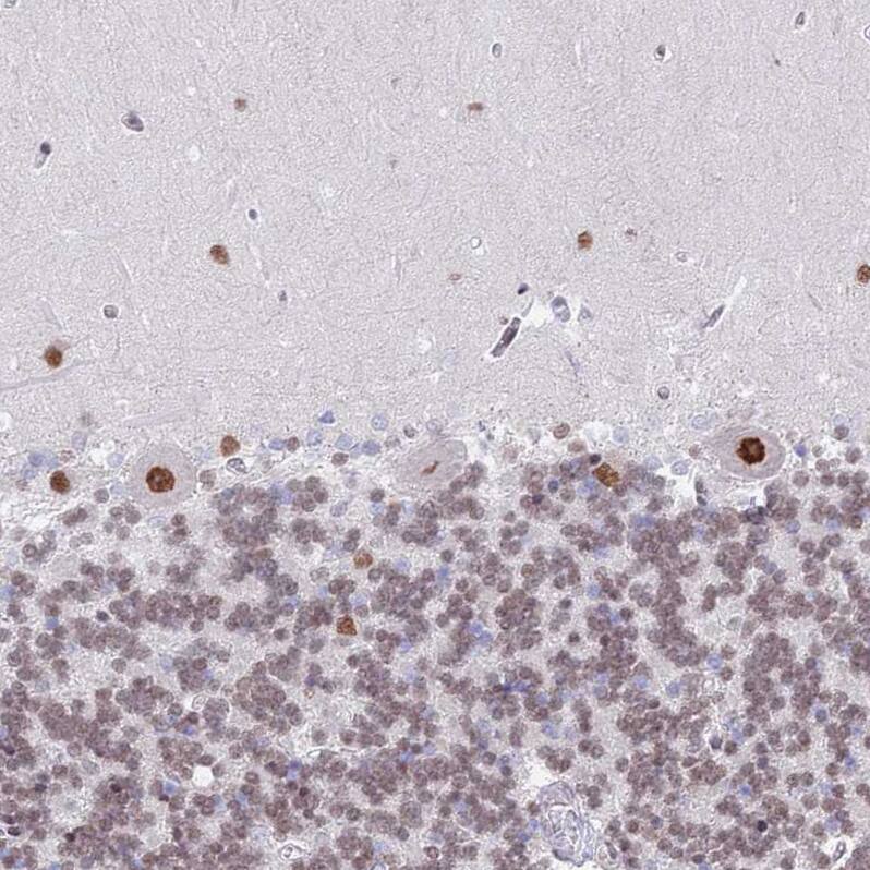 ZNF382 Antibody - BSA Free Immunohistochemistry: ZNF382 Antibody - BSA Free [NBP2-13569]