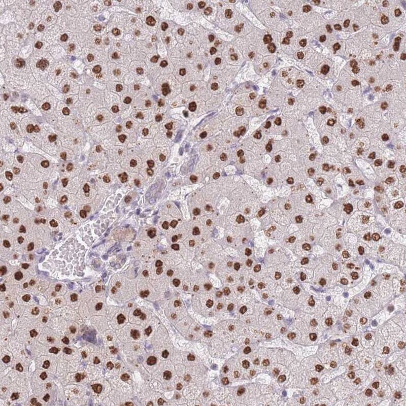 ZNF439 Antibody - BSA Free Immunohistochemistry: ZNF439 Antibody - BSA Free [NBP2-13574]