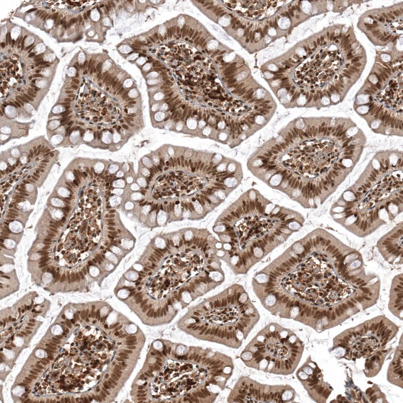 ZNF473 Antibody - BSA Free Immunohistochemistry-Paraffin: ZNF473 Antibody [NBP2-13575]
