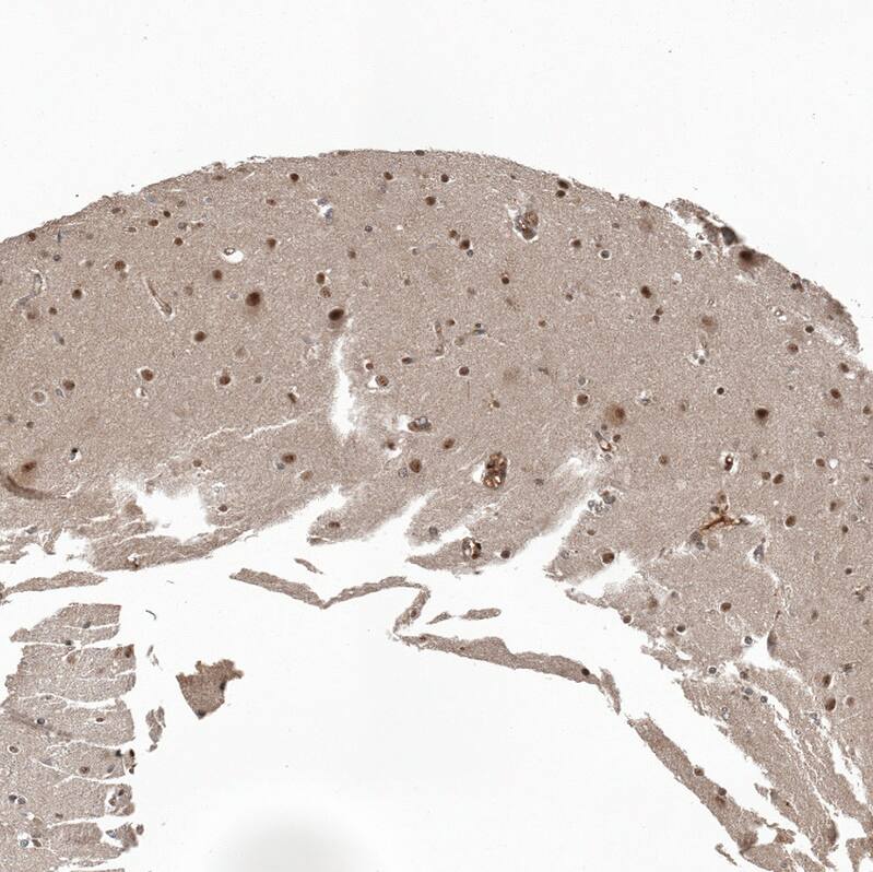 ZNF473 Antibody - BSA Free Immunohistochemistry: ZNF473 Antibody - BSA Free [NBP2-13575]