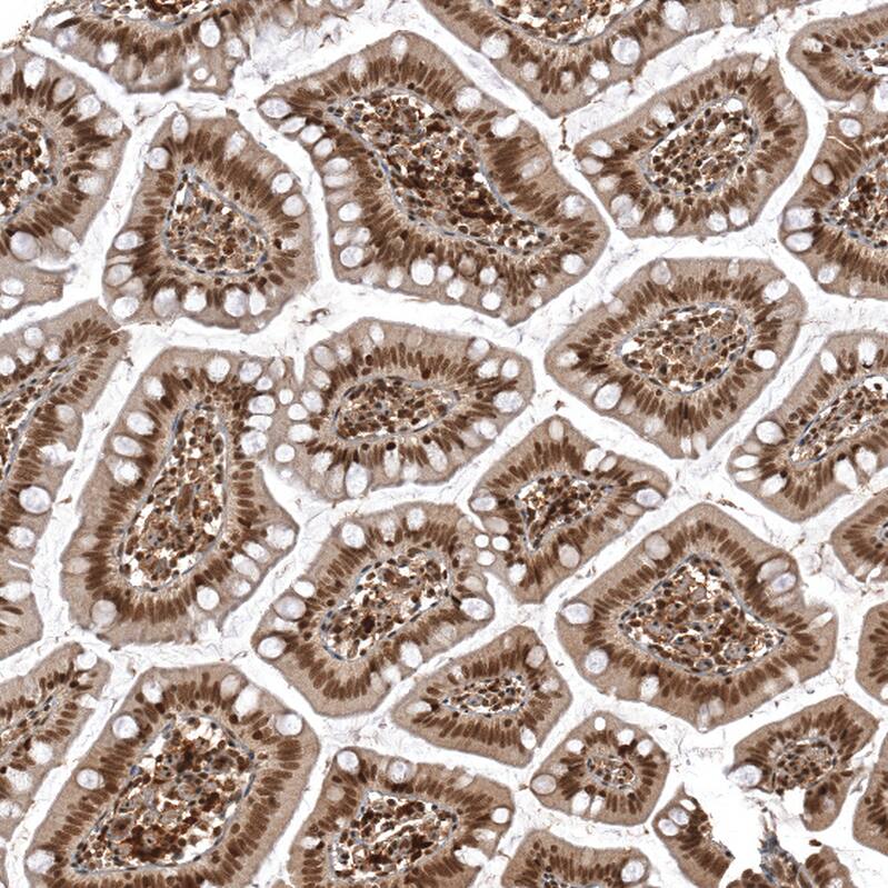 ZNF473 Antibody - BSA Free Immunohistochemistry: ZNF473 Antibody - BSA Free [NBP2-13575]