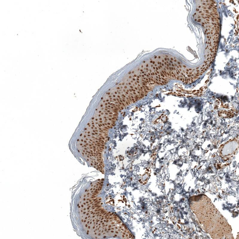 ZNF473 Antibody - BSA Free Immunohistochemistry: ZNF473 Antibody - BSA Free [NBP2-13575]