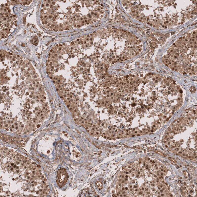 ZNF473 Antibody - BSA Free Immunohistochemistry: ZNF473 Antibody - BSA Free [NBP2-13575]