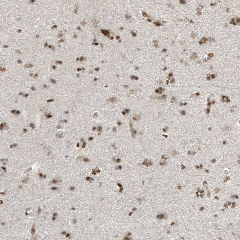 ZNF827 Antibody - BSA Free Immunohistochemistry: ZNF827 Antibody - BSA Free [NBP2-13599]