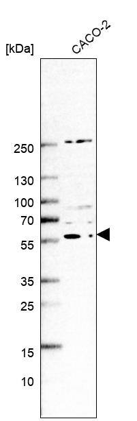 ZSWIM1 Antibody - BSA Free Western Blot: ZSWIM1 Antibody - BSA Free [NBP2-13606]