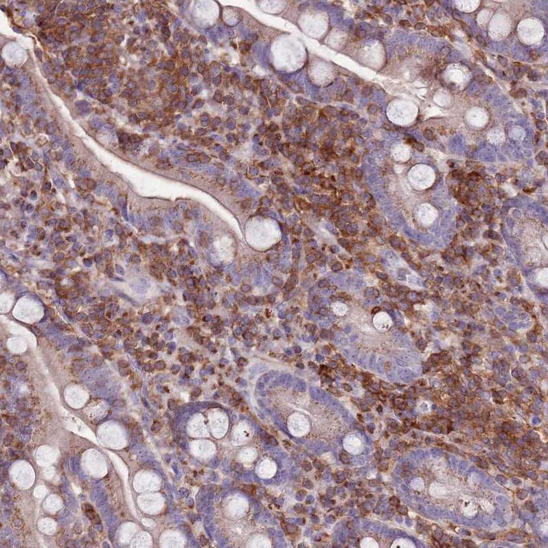 ZSWIM1 Antibody - BSA Free Immunohistochemistry: ZSWIM1 Antibody - BSA Free [NBP2-13607]