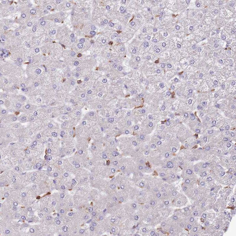 ZSWIM1 Antibody - BSA Free Immunohistochemistry: ZSWIM1 Antibody - BSA Free [NBP2-13607]