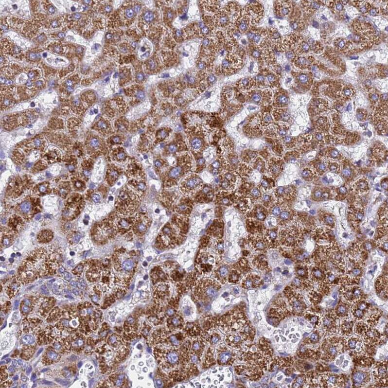 MRPS12 Antibody - BSA Free Immunohistochemistry: MRPS12 Antibody - BSA Free [NBP2-13620]