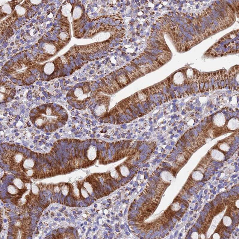 MRPS12 Antibody - BSA Free Immunohistochemistry: MRPS12 Antibody - BSA Free [NBP2-13620]