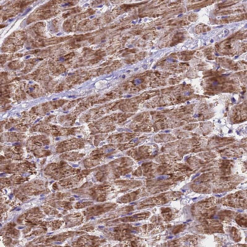 MRPS12 Antibody - BSA Free Immunohistochemistry: MRPS12 Antibody - BSA Free [NBP2-13620]
