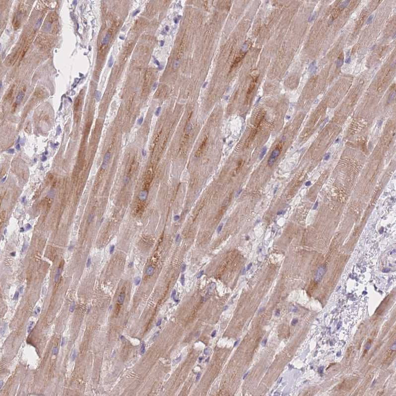 MRPS14 Antibody - BSA Free Immunohistochemistry: MRPS14 Antibody - BSA Free [NBP2-13622]