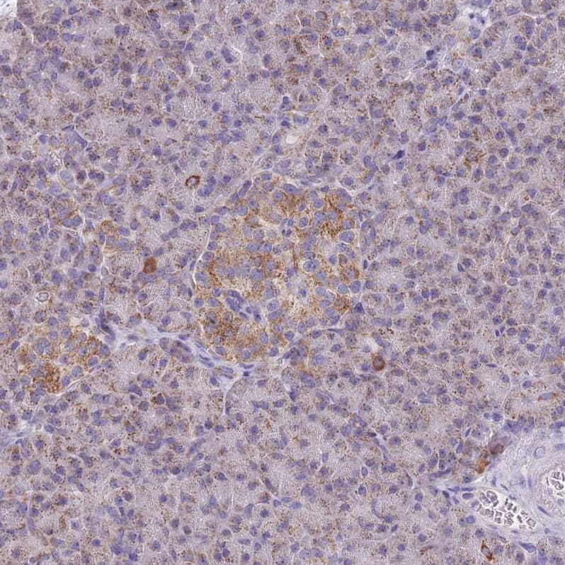 MRPS14 Antibody - BSA Free Immunohistochemistry: MRPS14 Antibody - BSA Free [NBP2-13622]