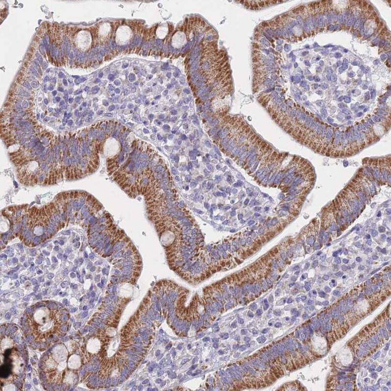 MRPS14 Antibody - BSA Free Immunohistochemistry: MRPS14 Antibody - BSA Free [NBP2-13622]