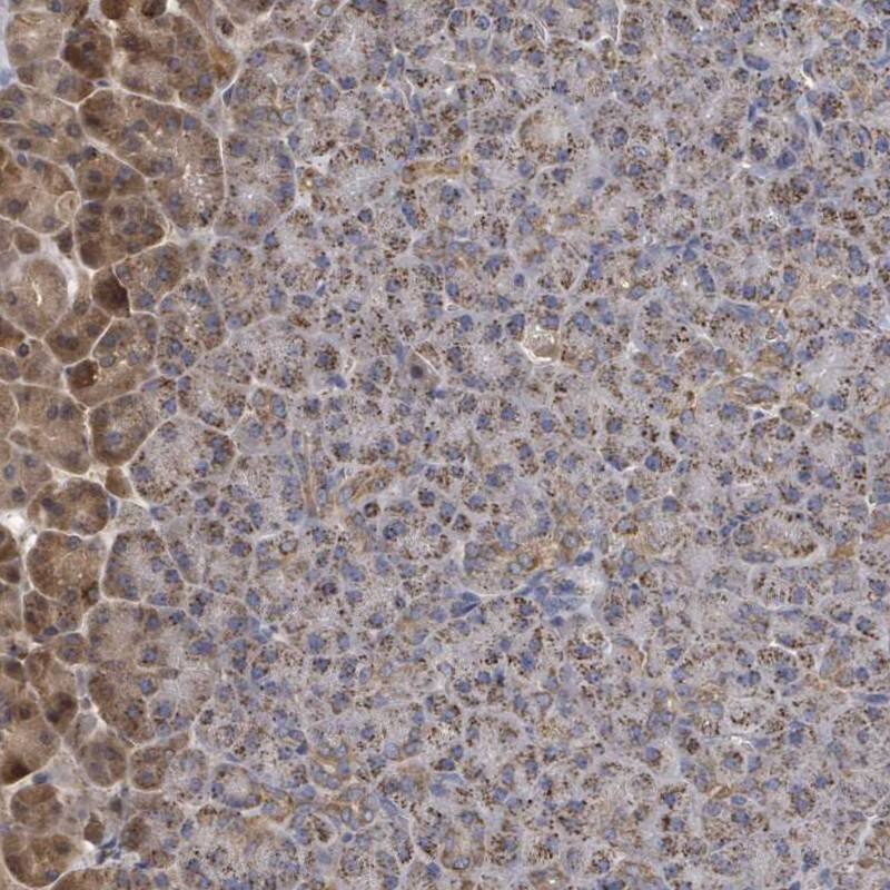 MTMR12 Antibody - BSA Free Immunohistochemistry: MTMR12 Antibody - BSA Free [NBP2-13625]