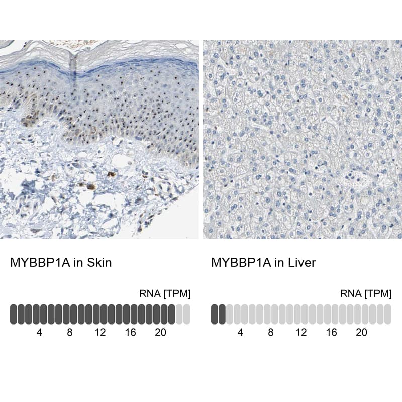 MYBBP1A Antibody - BSA Free Immunohistochemistry: MYBBP1A Antibody - BSA Free [NBP2-13630]
