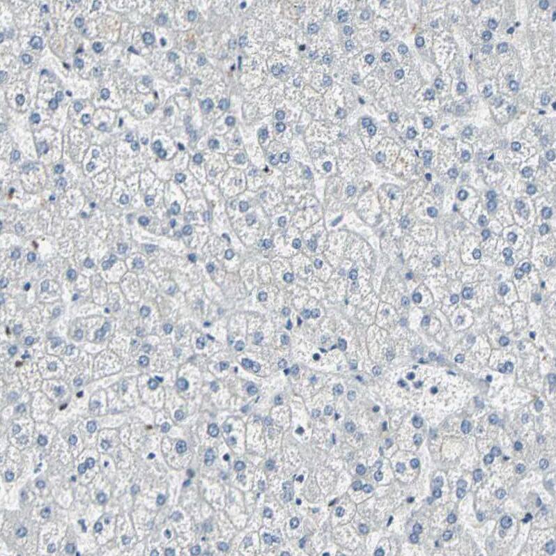 MYBBP1A Antibody - BSA Free Immunohistochemistry: MYBBP1A Antibody - BSA Free [NBP2-13630]