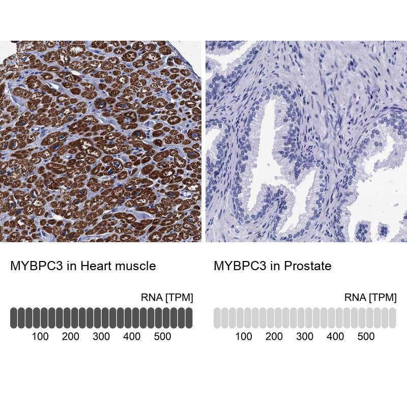 MyBPC3 Antibody - BSA Free Immunohistochemistry: MyBPC3 Antibody - BSA Free [NBP2-13631]