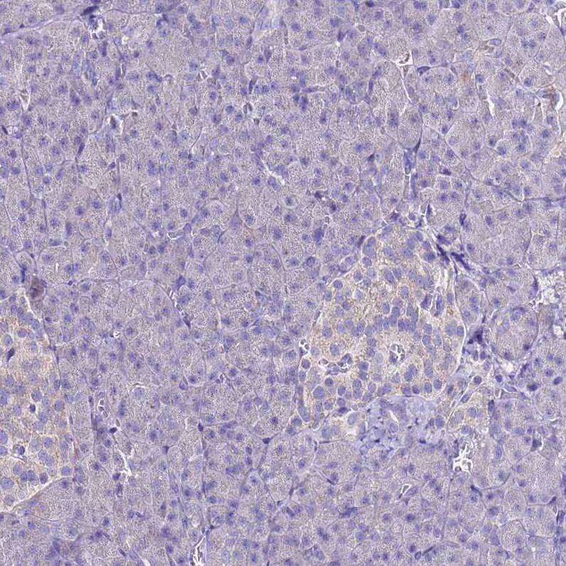 MyBPC3 Antibody - BSA Free Immunohistochemistry: MyBPC3 Antibody - BSA Free [NBP2-13632]