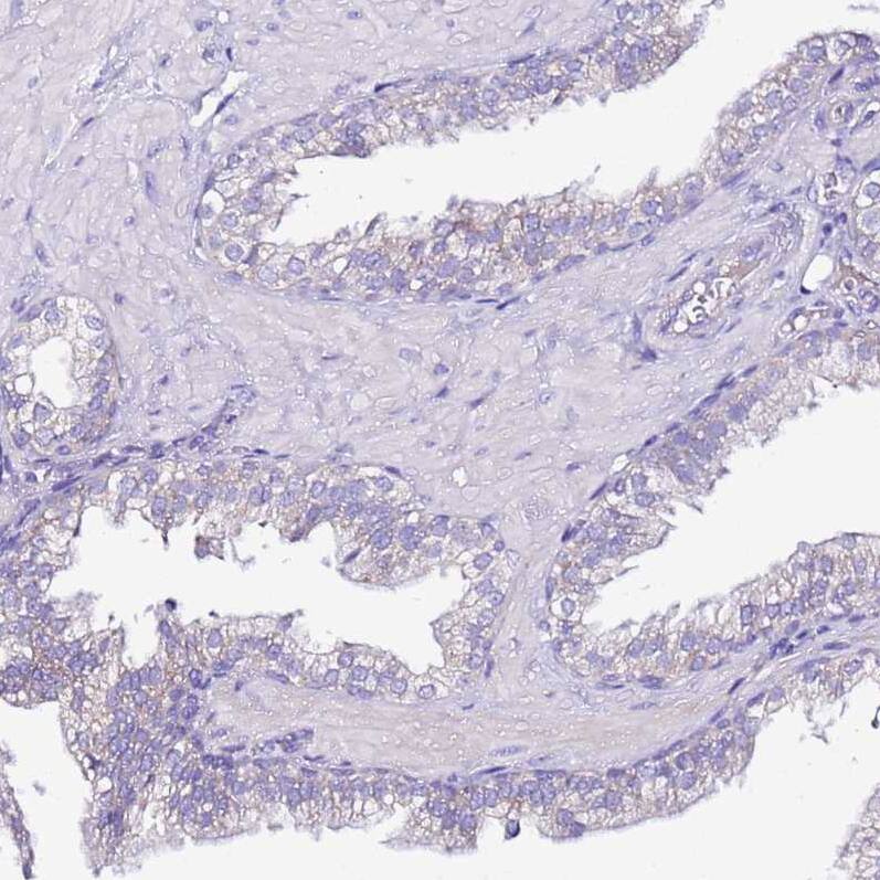 MyBPC3 Antibody - BSA Free Immunohistochemistry: MyBPC3 Antibody - BSA Free [NBP2-13632]