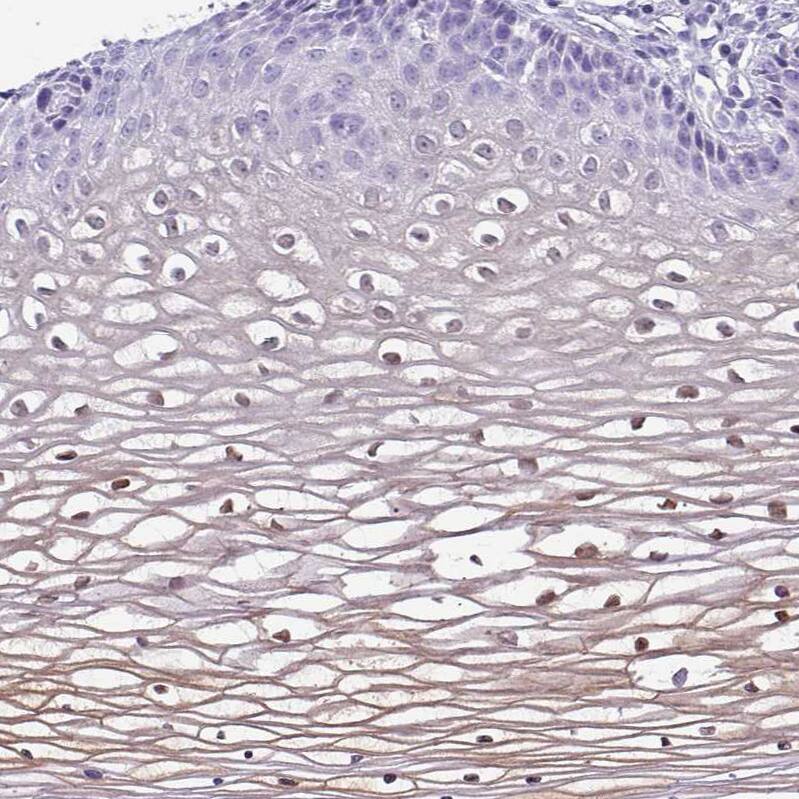 NCCRP1 Antibody - BSA Free Immunohistochemistry: NCCRP1 Antibody - BSA Free [NBP2-13642]