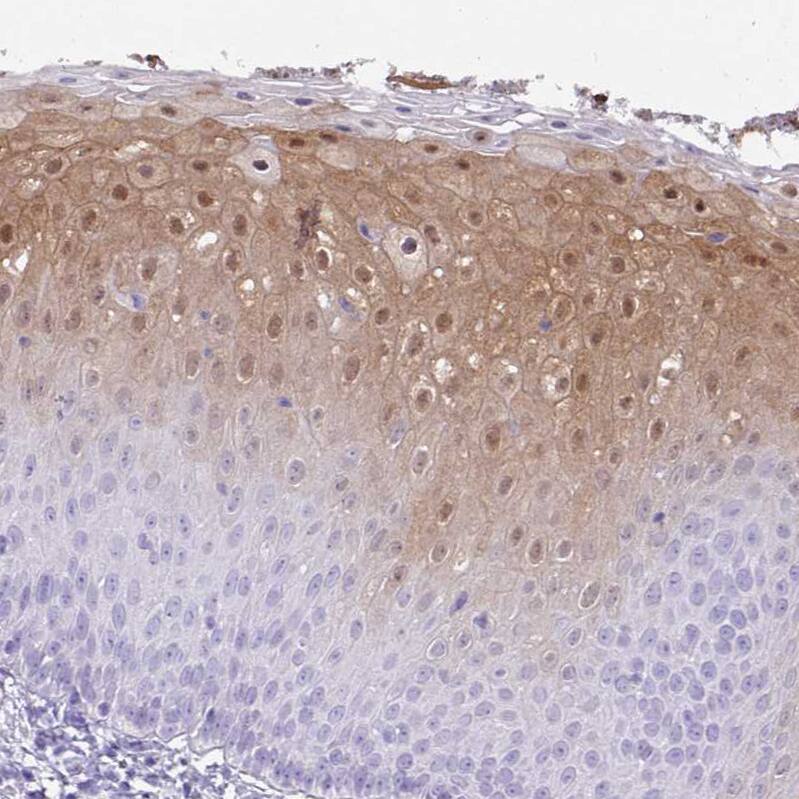NCCRP1 Antibody - BSA Free Immunohistochemistry: NCCRP1 Antibody - BSA Free [NBP2-13642]