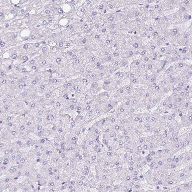 NCCRP1 Antibody - BSA Free Immunohistochemistry: NCCRP1 Antibody - BSA Free [NBP2-13642]