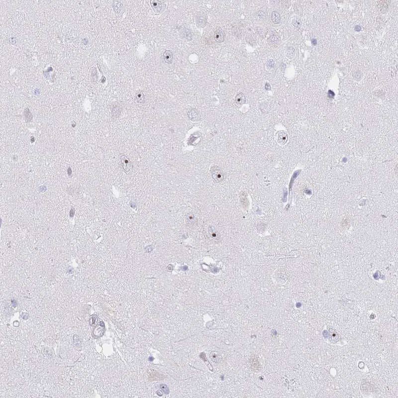 NOP14 Antibody - BSA Free Immunohistochemistry-Paraffin: NOP14 Antibody [NBP2-13665]