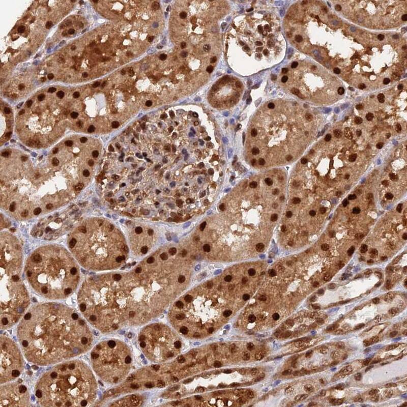 NPEPL1 Antibody - BSA Free Immunohistochemistry-Paraffin: NPEPL1 Antibody [NBP2-13668]