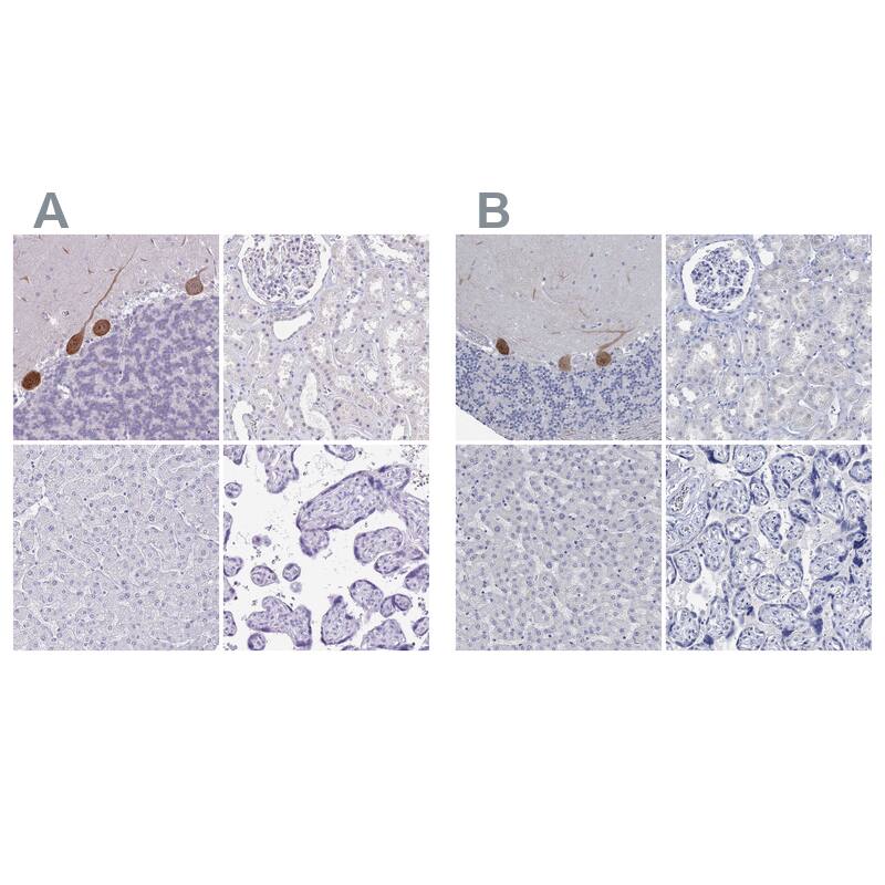 G-substrate Antibody Immunohistochemistry-Paraffin: G-substrate Antibody Antibody [NBP2-13800]