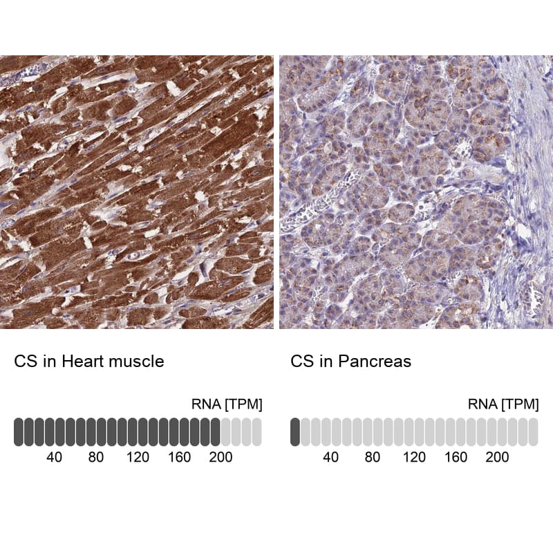 CS Citrate Synthase Antibody - BSA Free Immunohistochemistry-Paraffin: CS Citrate Synthase Antibody [NBP2-13877]