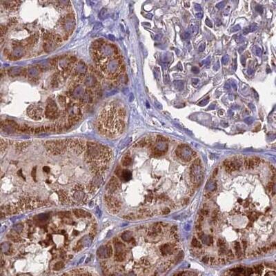 CS Citrate Synthase Antibody - BSA Free Immunohistochemistry-Paraffin: CS Citrate Synthase Antibody [NBP2-13877]