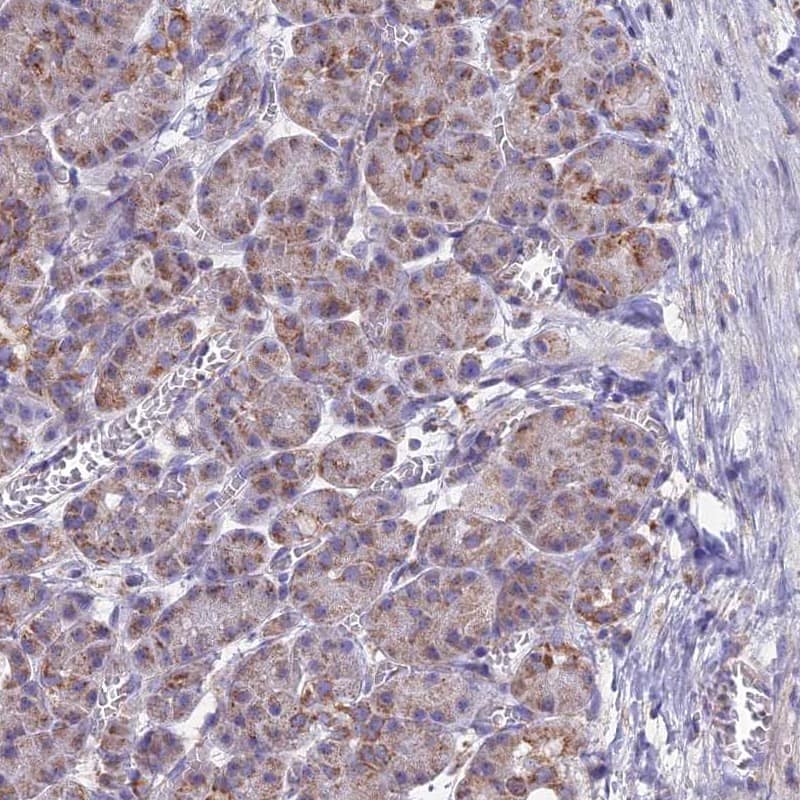 CS Citrate Synthase Antibody - BSA Free Immunohistochemistry-Paraffin: CS Citrate Synthase Antibody [NBP2-13877]
