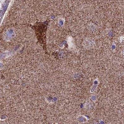 CS Citrate Synthase Antibody - BSA Free Immunohistochemistry-Paraffin: CS Citrate Synthase Antibody [NBP2-13877]