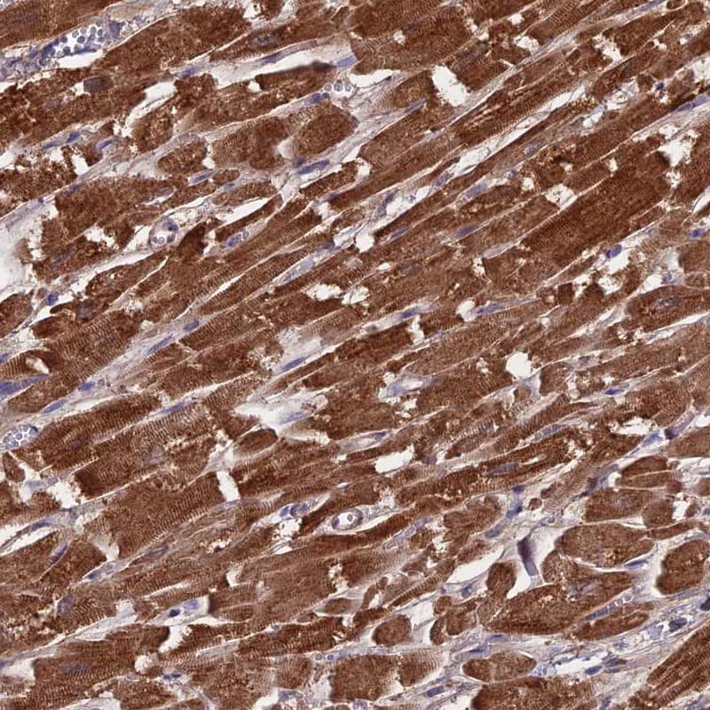 CS Citrate Synthase Antibody - BSA Free Immunohistochemistry-Paraffin: CS Citrate Synthase Antibody [NBP2-13877]