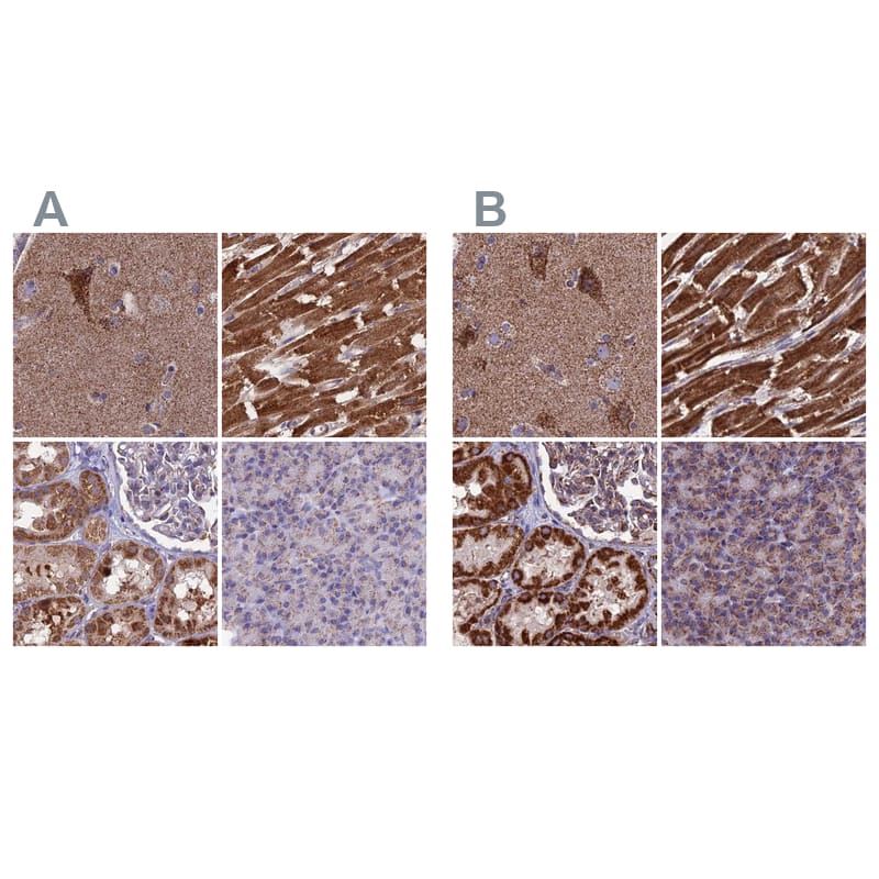 CS Citrate Synthase Antibody - BSA Free Immunohistochemistry-Paraffin: CS Citrate Synthase Antibody [NBP2-13877]