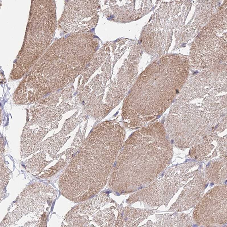 CS Citrate Synthase Antibody - BSA Free Immunohistochemistry-Paraffin: CS Citrate Synthase Antibody [NBP2-13878]