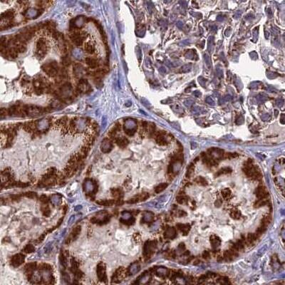 CS Citrate Synthase Antibody - BSA Free Immunohistochemistry-Paraffin: CS Citrate Synthase Antibody [NBP2-13878]