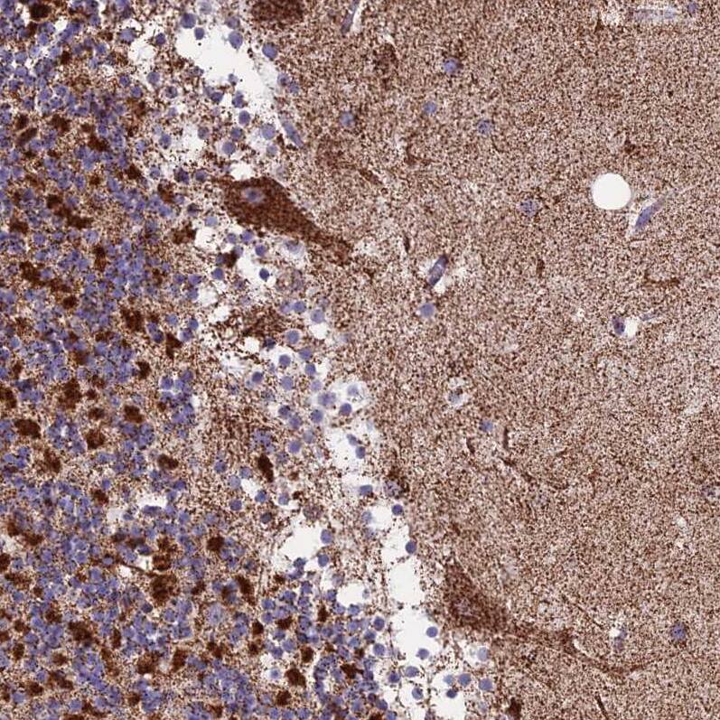 CS Citrate Synthase Antibody - BSA Free Immunohistochemistry-Paraffin: CS Citrate Synthase Antibody [NBP2-13878]
