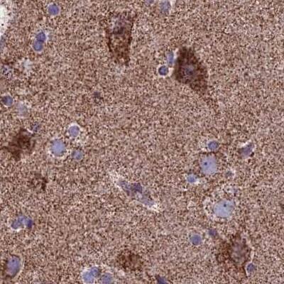 CS Citrate Synthase Antibody - BSA Free Immunohistochemistry-Paraffin: CS Citrate Synthase Antibody [NBP2-13878]