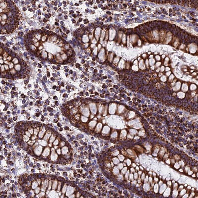 CS Citrate Synthase Antibody - BSA Free Immunohistochemistry-Paraffin: CS Citrate Synthase Antibody [NBP2-13878]