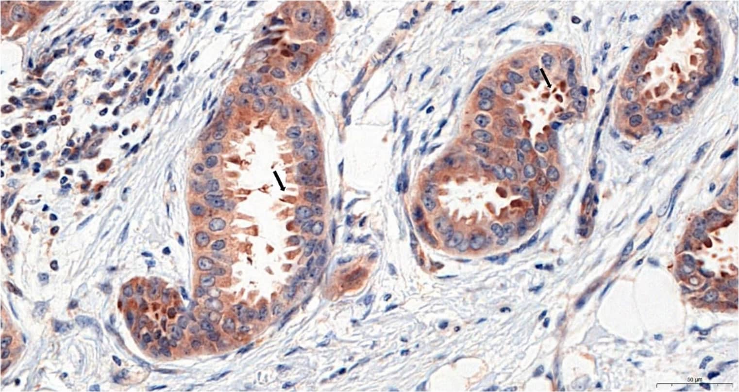 Irisin/FNDC5 Antibody