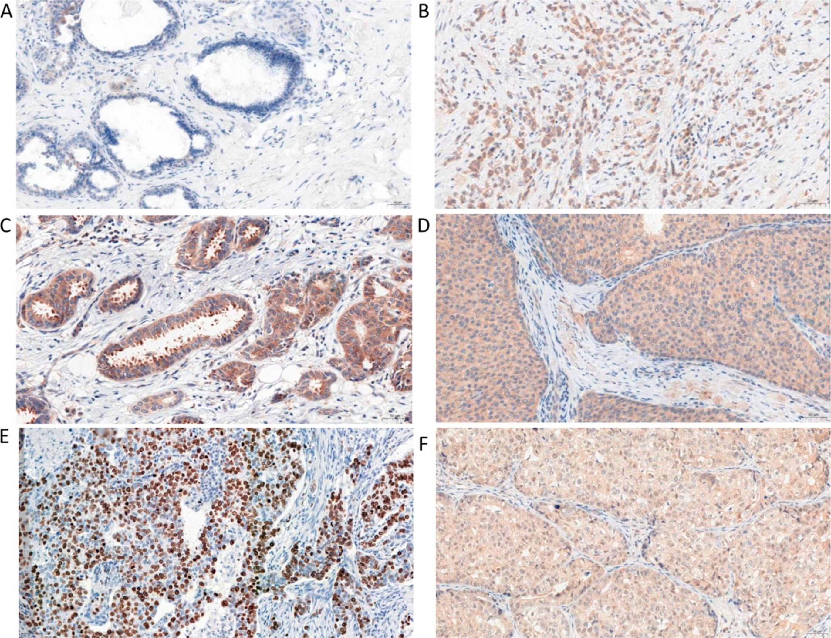 Irisin/FNDC5 Antibody