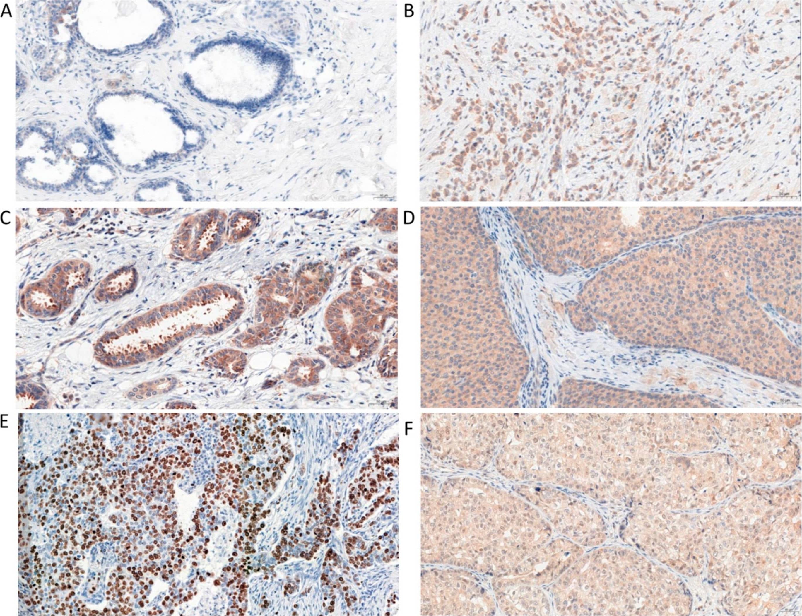 Irisin/FNDC5 Antibody