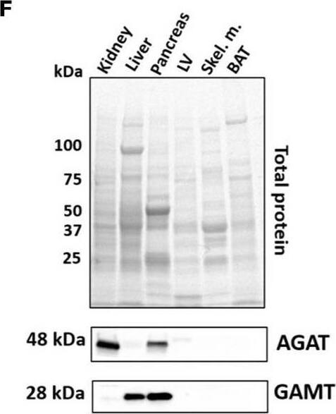 GAMT Antibody - BSA Free